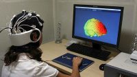 Δοκιμάστηκε ο πρώτος «βηματοδότης» εγκεφάλου σε ασθενείς με Αλτσχάιμερ