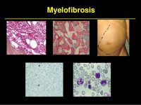 H-Novartis-παρουσιάζει-τη-νέα-mobile-εφαρμογή-“MPN-Assistant-GR”-για-ασθενείς-με-μυελοΐνωση-και-αληθή-πολυκυτταραιμία-200x150.jpg