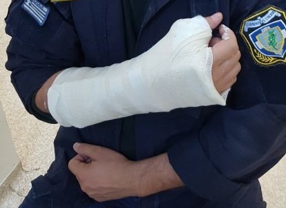 POLICENEWS_ΜΕΝΙΔΙ_ΕΠΙΘΕΣΗ-ΑΣΤΥΝΟΜΙΚΟ-ΡΟΜΑ