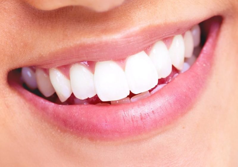 ahealthysmile-800x562.jpg